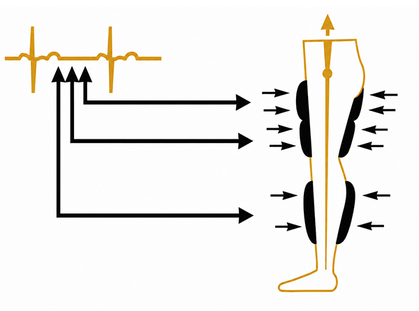 EECP therapy — cuffs inflate during diastole to increase blood flow to the heart